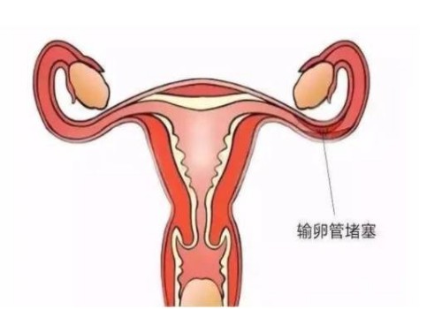 怀孕期间来了月经究竟是怎么一回事？